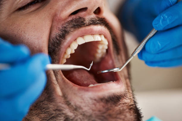 Best Urgent Dental Care for Toothaches in Shady Point, OK