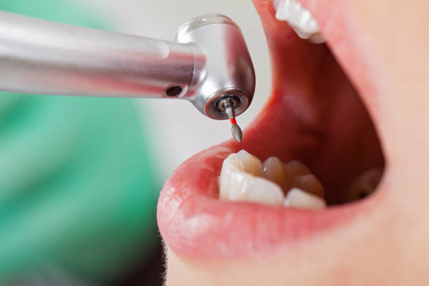 Trusted OK Emergency Dental Service Experts